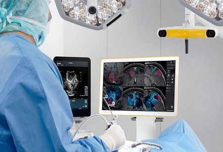 Tata Memorial Centre Revolutionizes Neurosurgery with Advanced Ultrasound Tech